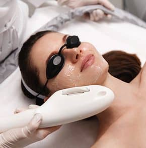 TO IPL Photofacial