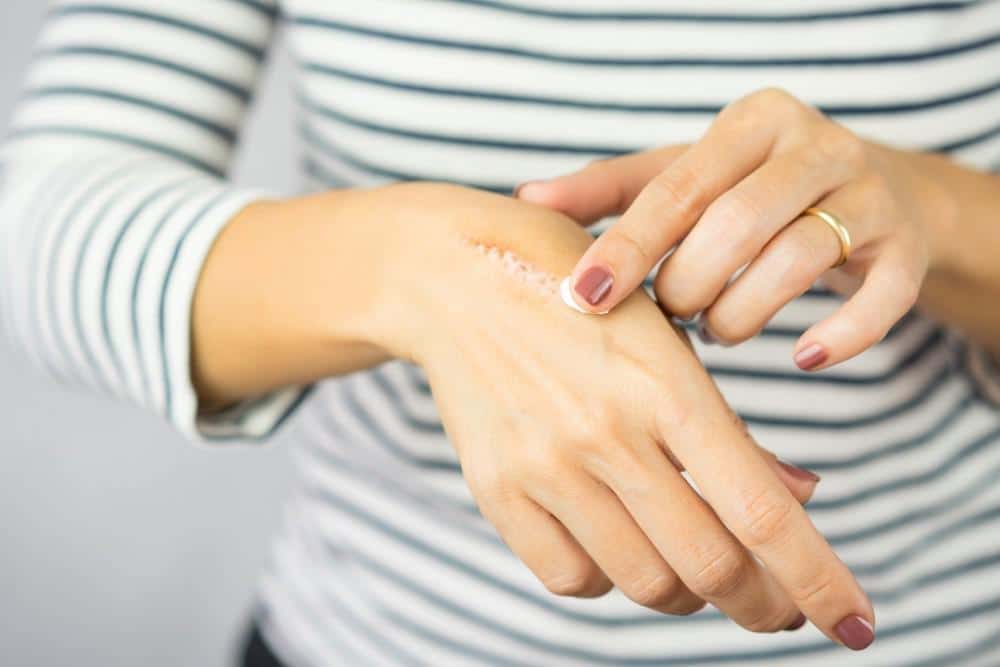 Are Scars Permanent?: Learn About our Laser Scar Removal Treatment 65f3490753970.jpeg