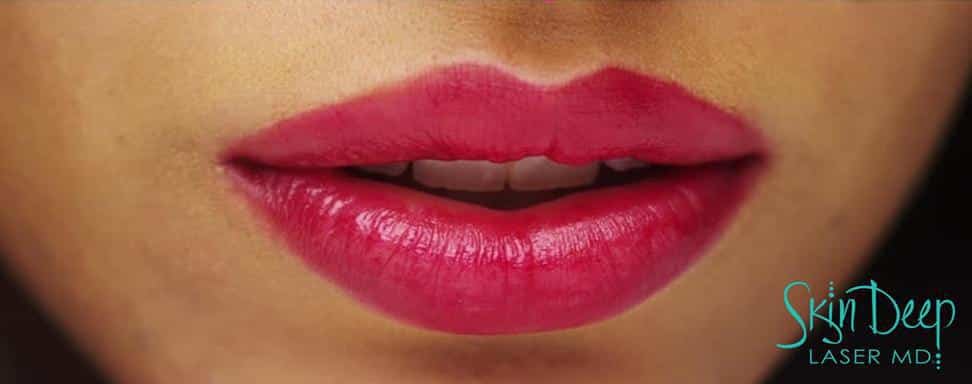 The Top 10 Things You Want to Know About Lip Filler 65f3556f5df72.jpeg