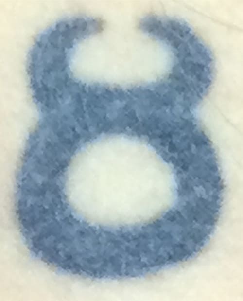 Before Image: Laser Tattoo Removal - front