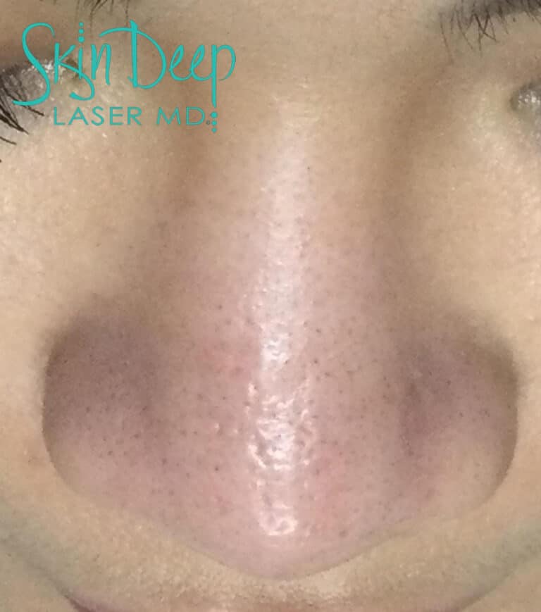 After Image: Scars & Stretch Marks - front