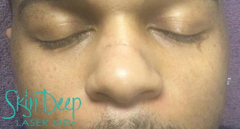 After Image: Scars & Stretch Marks - front