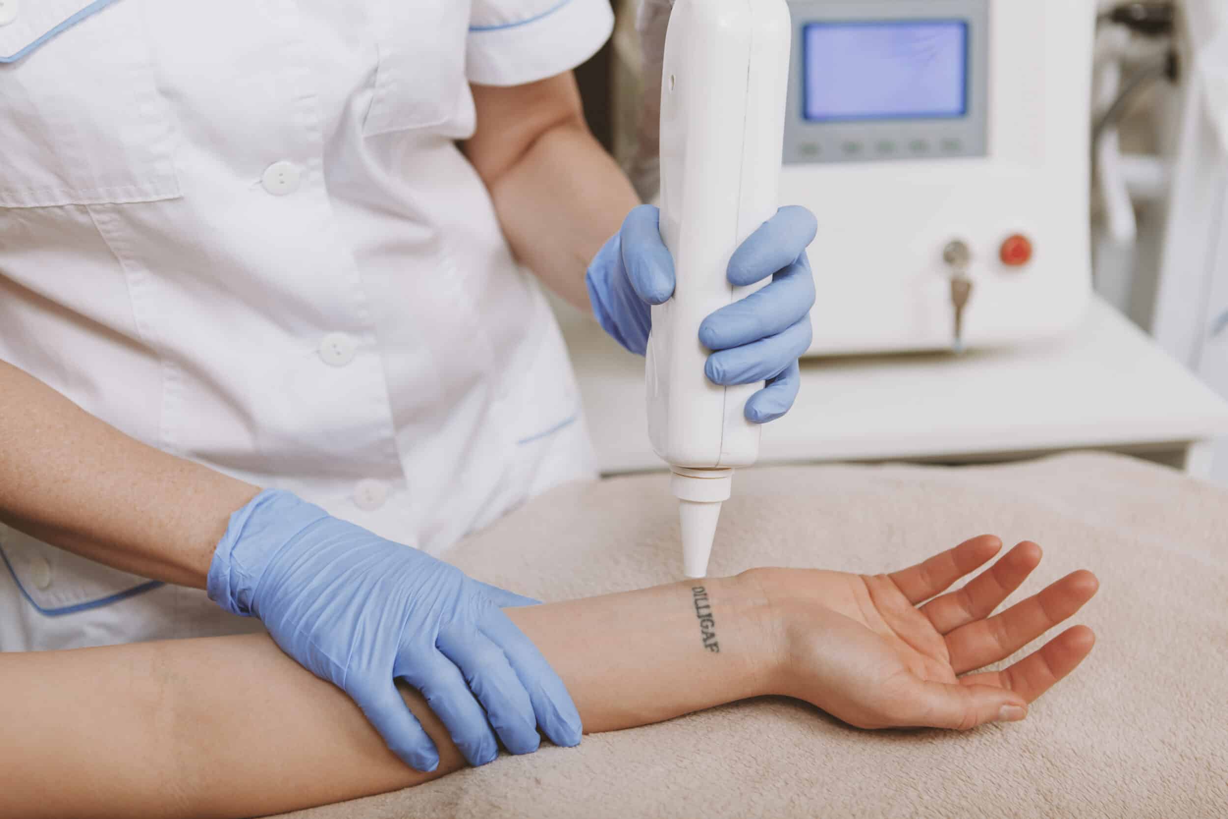 A woman undergoing tattoo removal on her wrist