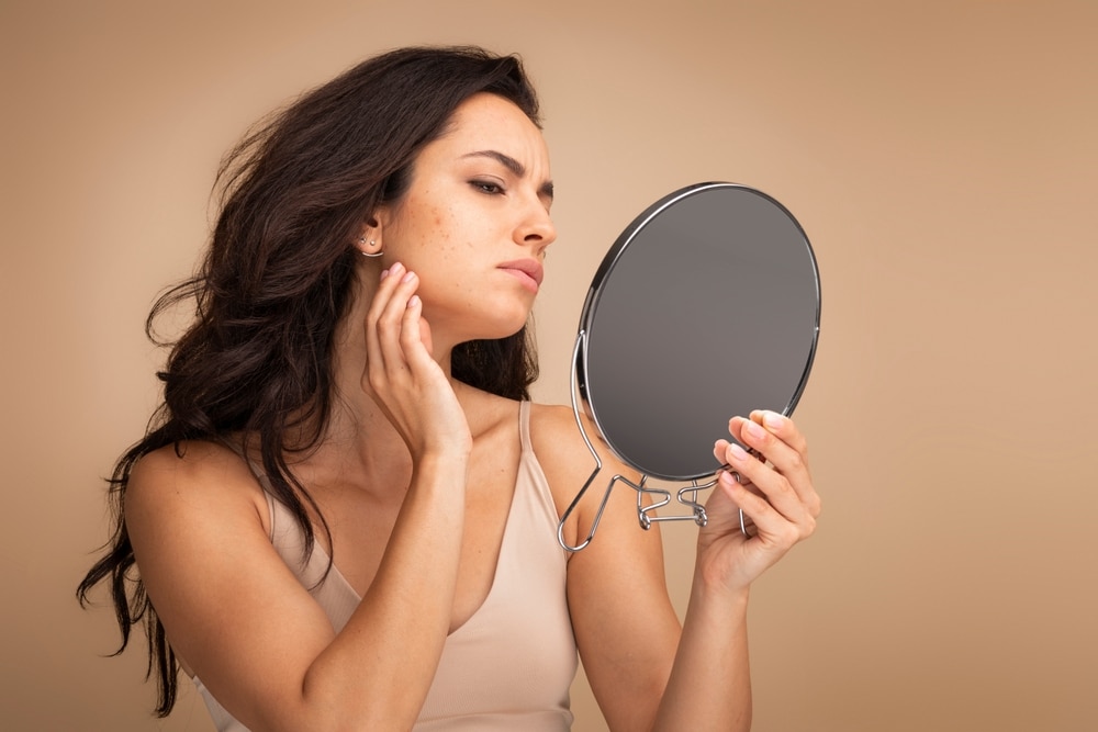 A woman with age spots looking in the mirror
