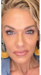 After Image: Skin Rejuvenation