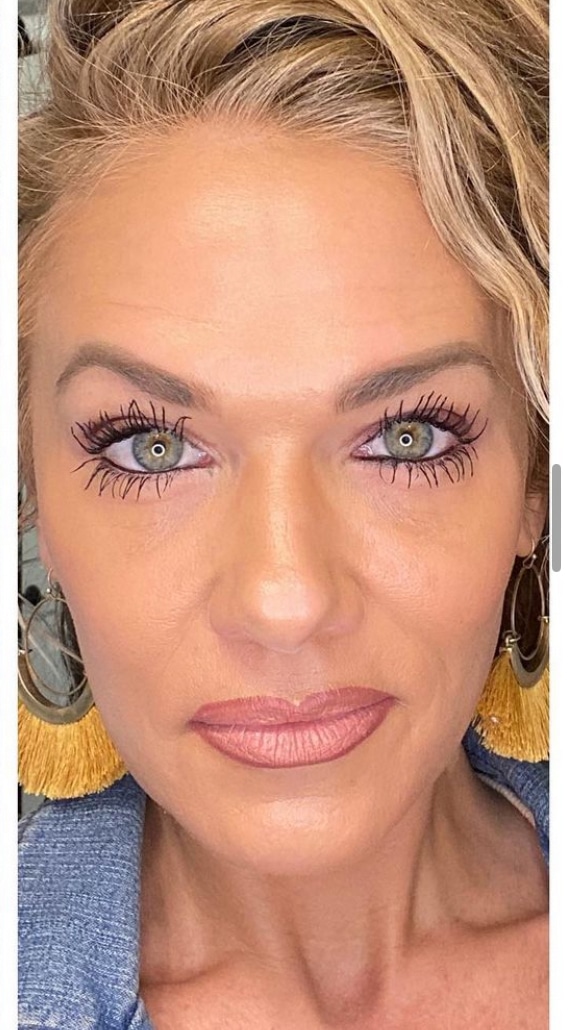 After Image: Skin Rejuvenation - front
