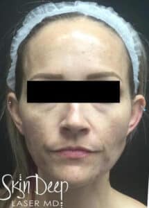 After Image: Peel