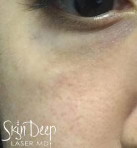 After Image: Pico Pigment