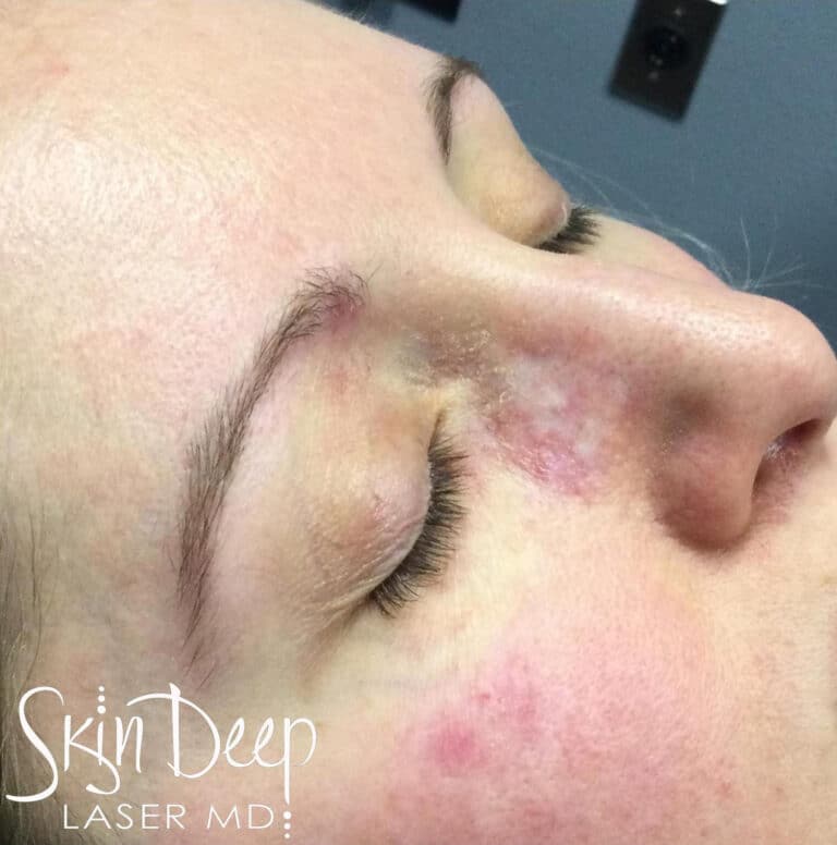 After Image: IPL Port Wine - right-front-oblique